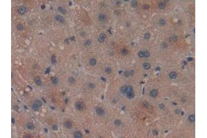 Detection of LILRB2 in Human Liver Tissue using Polyclonal Antibody to Leukocyte Immunoglobulin Like Receptor Subfamily B, Member 2 (LILRB2) (LILRB2 antibody  (AA 53-255))