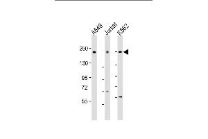 All lanes : Anti-PSME4 Antibody (N-Term) at 1:2000 dilution Lane 1: A549 whole cell lysate Lane 2: Jurkat whole cell lysate Lane 3: K562 whole cell lysate Lysates/proteins at 20 μg per lane. (PSME4 antibody  (AA 503-535))
