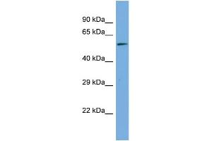 Host:  Rabbit  Target Name:  MAGED2  Sample Type:  Hela Whole Cell lysates  Antibody Dilution:  1. (MAGED2 antibody  (Middle Region))