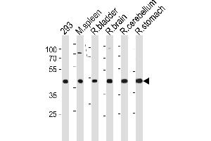 Rat Ccdc89 Antibody (Center) (ABIN1881712 and ABIN2843622) western blot analysis in 293 cell line,mouse spleen,rat bladder,brain,cerebellum and stomach tissue lysates (35 μg/lane). (CCDC89 antibody  (AA 114-145))