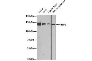 Western blot analysis of extracts of various cell lines, using N4BP1 antibody. (N4BP1 antibody  (AA 190-590))