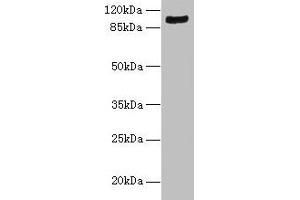Western blot All lanes: TMTC1 antibody at 6 μg/mL + Mouse large intestine tissue Secondary Goat polyclonal to rabbit IgG at 1/10000 dilution Predicted band size: 99, 88, 74, 66, 26 kDa Observed band size: 99 kDa (TMTC1 antibody  (AA 1-227))