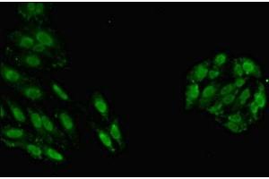 Immunofluorescent analysis of HepG2 cells using ABIN7154122 at dilution of 1:100 and Alexa Fluor 488-congugated AffiniPure Goat Anti-Rabbit IgG(H+L) (GSTT1 antibody  (AA 2-240))