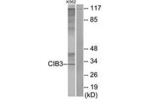 Western blot analysis of extracts from K562 cells, using CIB3 Antibody. (CIB3 antibody  (AA 138-187))