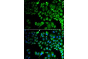 Immunofluorescence analysis of A549 cell using JMJD7 antibody. (JMJD7 antibody)