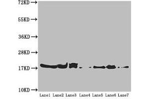 Western blot All lanes: ATP5H antibody at 5. (ATP5H antibody  (AA 1-161))