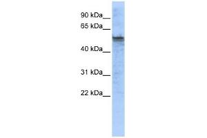 TPH2 antibody used at 1 ug/ml to detect target protein. (Tryptophan Hydroxylase 2 antibody  (Middle Region))