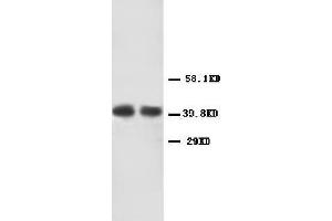 Anti-CXCR2 antibody, Western blotting Lane 1: Human Rectal Cancer Tissue Lysate Lane 2: Human Rectal Cancer Tissue Lysate (CXCR2 antibody  (Middle Region))