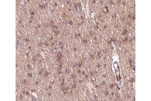 ABIN6266547 at 1/200 staining human brain tissue sections by IHC-P. (mGluR2/3 antibody)