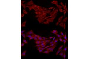 Immunofluorescence (IF) image for anti-Fatty Acid Binding Protein 5 (Psoriasis-Associated) (FABP5) (AA 1-135) antibody (ABIN6140422)