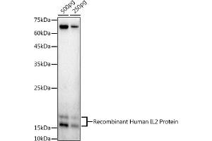 Western blot analysis of extracts of Recombinant Human IL2 Protein, using IL2 antibody (ABIN3020908, ABIN3020909, ABIN3020910 and ABIN6213790) at 1:1000 dilution. (IL-2 antibody  (AA 21-153))