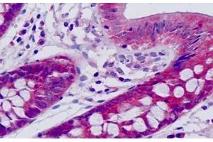 Human, Small intestine: Formalin-Fixed Paraffin-Embedded (FFPE) (HARS1/Jo-1 antibody  (AA 460-509))