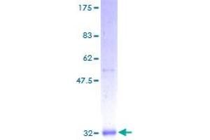 SCGB1A1 Protein (AA 1-91) (GST tag)