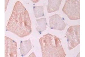 Detection of ENG in Rat Skeletal muscle Tissue using Polyclonal Antibody to Endoglin (ENG) (Endoglin antibody  (AA 26-136))