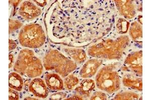 Immunohistochemistry of paraffin-embedded human kidney tissue using ABIN7155721 at dilution of 1:100 (HOXA5 antibody  (AA 1-270))