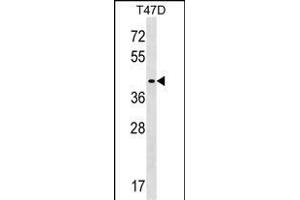 ADHC Antibody (C-term) (ABIN1536884 and ABIN2849555) western blot analysis in T47D cell line lysates (35 μg/lane). (MMADHC antibody  (C-Term))