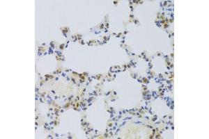 Immunohistochemistry of paraffin-embedded rat lung using HMGB1 Antibody. (HMGB1 antibody  (AA 100-200))