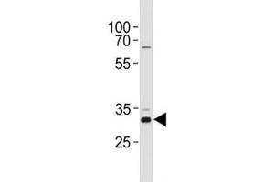 CCND1 antibody western blot analysis in HeLa lysate.