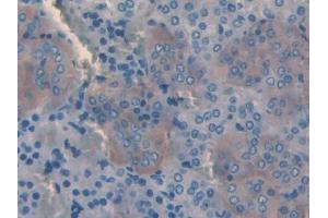 IHC-P analysis of Rat Adrenal gland Tissue, with DAB staining. (SLIT3 antibody  (AA 62-119))
