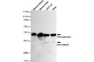Western blot detection of DR5 in Mouse kindey,Mouse brain,HC and Hela cell lysates using DR5 mouse mAb (1:500-1:2000 diluted). (TNFRSF10B antibody)