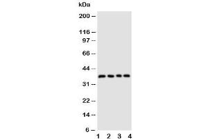 Western blot testing of CD1d antibody and Lane 1:  COLO320 (CD1d antibody  (AA 76-92))