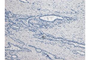Immunohistochemistry (IHC) image for anti-Kallikrein 2 (KLK2) (Internal Region) antibody (ABIN190842)