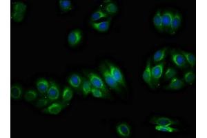 Immunofluorescence staining of HepG2 cells with ABIN7163307 at 1:66, counter-stained with DAPI. (PIRT antibody  (AA 1-55))