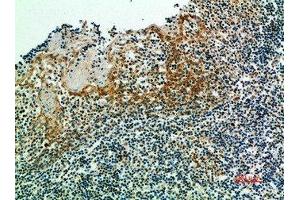Immunohistochemical analysis of paraffin-embedded human-tonsils, antibody was diluted at 1:200 (IRF3 antibody  (AA 1268-1341))