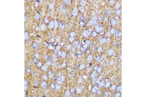 Immunohistochemistry of paraffin-embedded mouse brain using SN Rabbit pAb (ABIN3021231, ABIN3021232, ABIN3021233 and ABIN6214078) at dilution of 1:100 (40x lens).