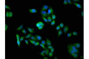 Immunofluorescence staining of Hela cells with ABIN7150124 at 1:100, counter-stained with DAPI. (DDB1 antibody  (AA 741-943))