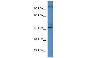 Western Blotting (WB) image for anti-Ataxia, Cerebellar, Cayman Type (ATCAY) (C-Term) antibody (ABIN926621)