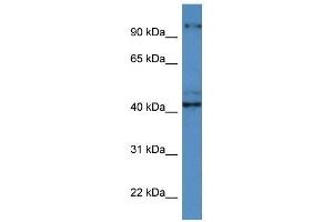 Western Blot showing ATCAY antibody used at a concentration of 1 ug/ml against ACHN Cell Lysate (ATCAY antibody  (C-Term))