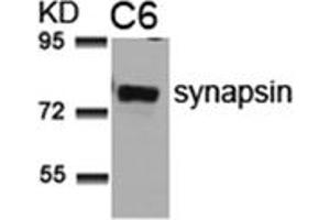 Image no. 1 for anti-Synapsin I (SYN1) (AA 7-11) antibody (ABIN197522)