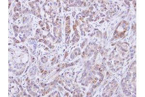 Immunohistochemistry (IHC) image for anti-Protein tyrosine Phosphatase, Non-Receptor Type 11 (PTPN11) (C-Term) antibody (ABIN2854914)