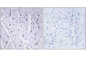 Immunohistochemistry analysis of paraffin-embedded human heart, using MYB (Phospho-Ser12) Antibody. (MYB antibody  (pSer12))