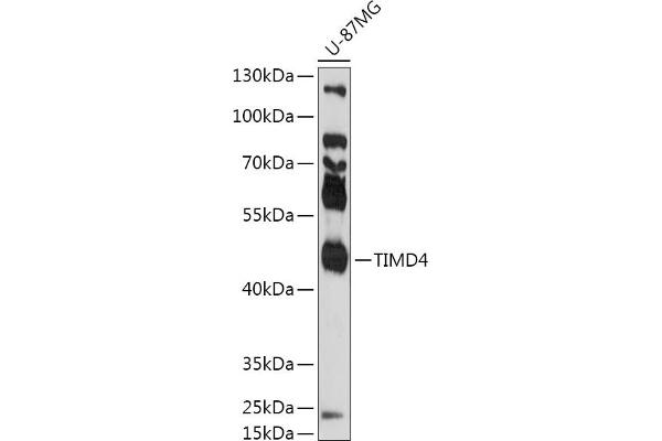 TIMD4 Antikörper  (AA 25-130)