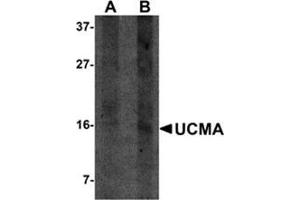Western blot analysis of UCMA in SW1353 cell lysate with this product at (A) 2. (UCMA antibody  (C-Term))