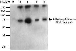 Western Blot analysis of 4-hydroxy-2-hexanal-BSA Conjugate showing detection of 67 kDa 4-hydroxy-2-hexenal-BSA using Mouse Anti-4-hydroxy-2-hexenal Monoclonal Antibody, Clone 6F10 . (4-Hydroxy-2-Hexenal (4-HHE) antibody (Biotin))