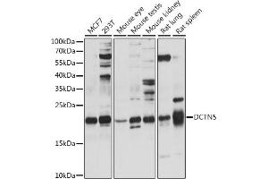 Western blot analysis of extracts of various cell lines, using DCTN5 antibody (ABIN7266853) at 1:1000 dilution. (DCTN5 antibody  (AA 1-100))