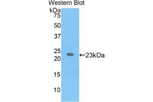 Western blot analysis of the recombinant protein. (IL17 Receptor B antibody  (AA 310-499))