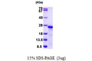 SDS-PAGE (SDS) image for Myosin Regulatory Light Chain 2, Smooth Muscle Isoform (MYL9) (AA 1-172) protein (His tag) (ABIN667358)