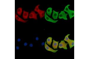 ABIN7096241 and ABIN7100303 staining Hela cells by IF/ICC. (SAMD3 antibody)