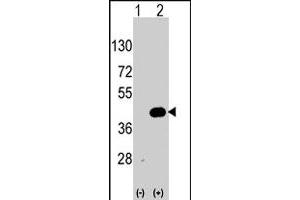 Western blot analysis of WIF1 (arrow) using WIF1 polyclonal antibody . (WIF1 antibody  (AA 350-379))