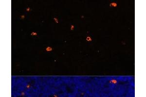 Immunofluorescence analysis of Rat bone marrow using CAMP Polyclonal Antibody at dilution of 1:100. (Cathelicidin antibody)