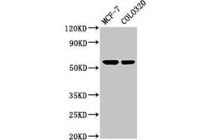 Western Blot Positive WB detected in: MCF-7 whole cell lysate, Colo320 whole cell lysate All lanes: MYOC antibody at 5. (MYOC antibody  (AA 183-294))