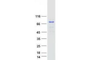 Validation with Western Blot