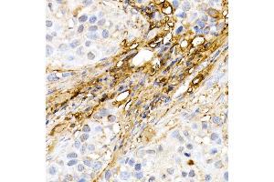 Immunohistochemistry of paraffin-embedded human colon using ASC/TMS1 Rabbit pAb (ABIN6131200, ABIN6146515, ABIN6146516 and ABIN6215212) at dilution of 1:150 (40x lens). (PYCARD antibody  (AA 50-195))