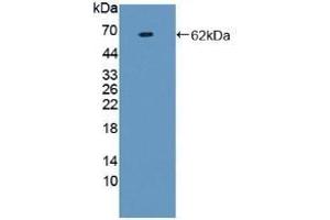 Detection of Recombinant F1+2, Human using Monoclonal Antibody to Prothrombin Fragment 1+2 (F1+2) (Prothrombin Fragment 1+2 antibody)