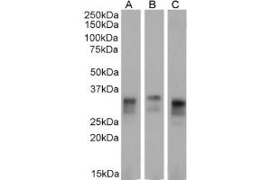 Western Blot using anti-major Prion protein antibody 3F4. (Recombinant PRNP antibody)