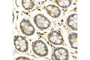 Immunohistochemistry of paraffin embedded human colon using ANXA3 (ABIN7073065) at dilution of 1: 200 (400x lens) (Annexin A3 antibody)